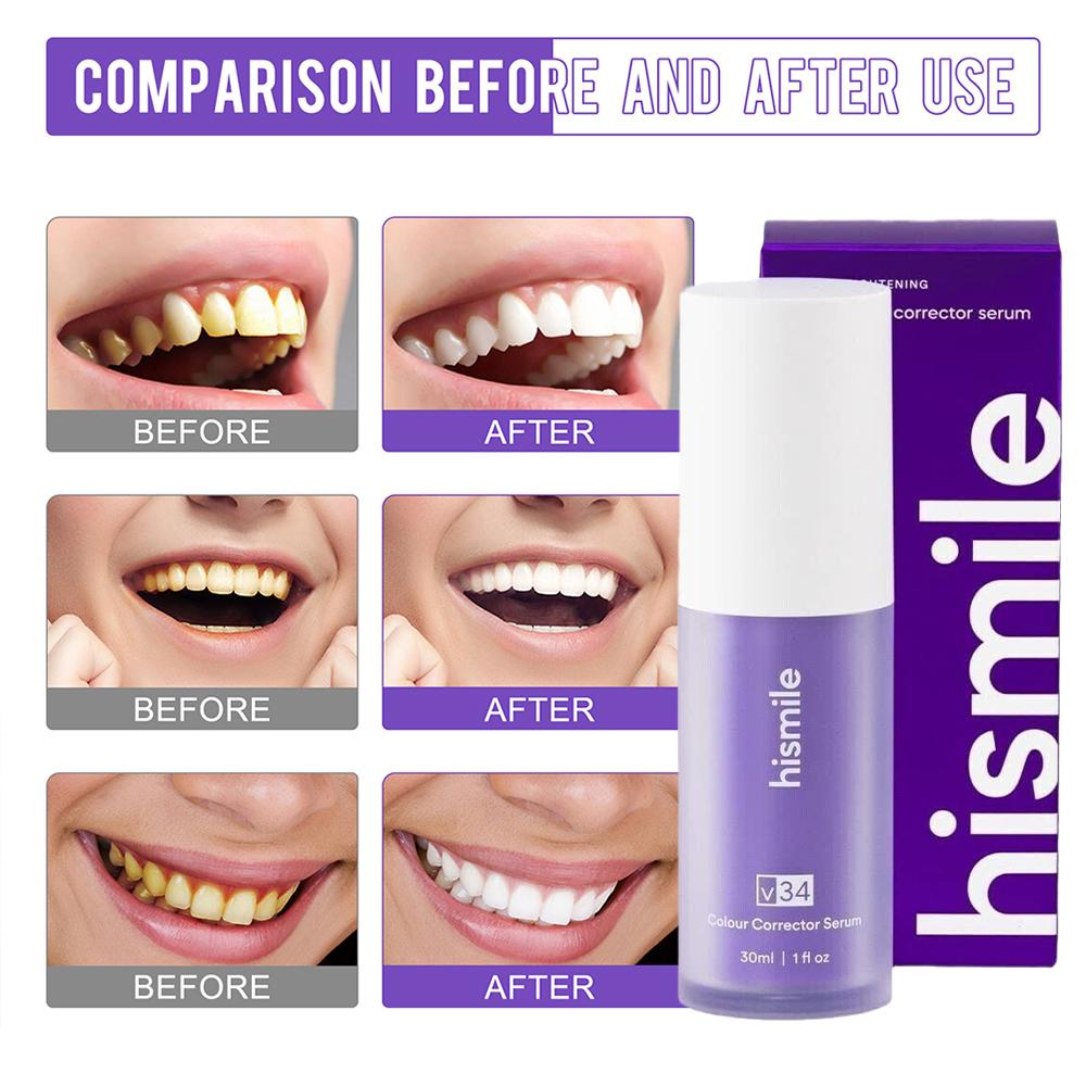 Teeth Whitening Hismile - Pasta Dental Blanqueadora Hismile Purple, Corrector