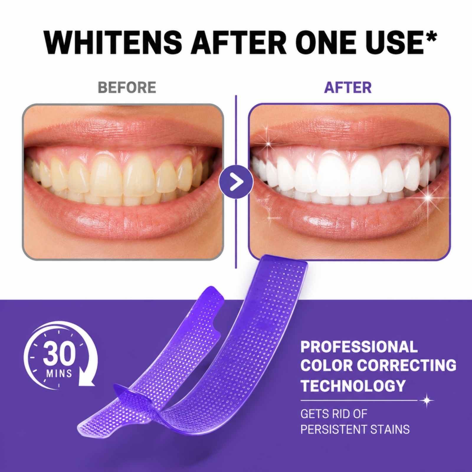 7/14/21/28 Tiras Blanqueadoras - Whitening Strip 3D reseña y precio