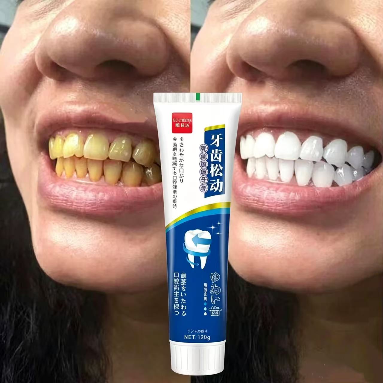Pasta de Dientes Japonesa Impo - Teeth Whitening Japanese reseña y precio