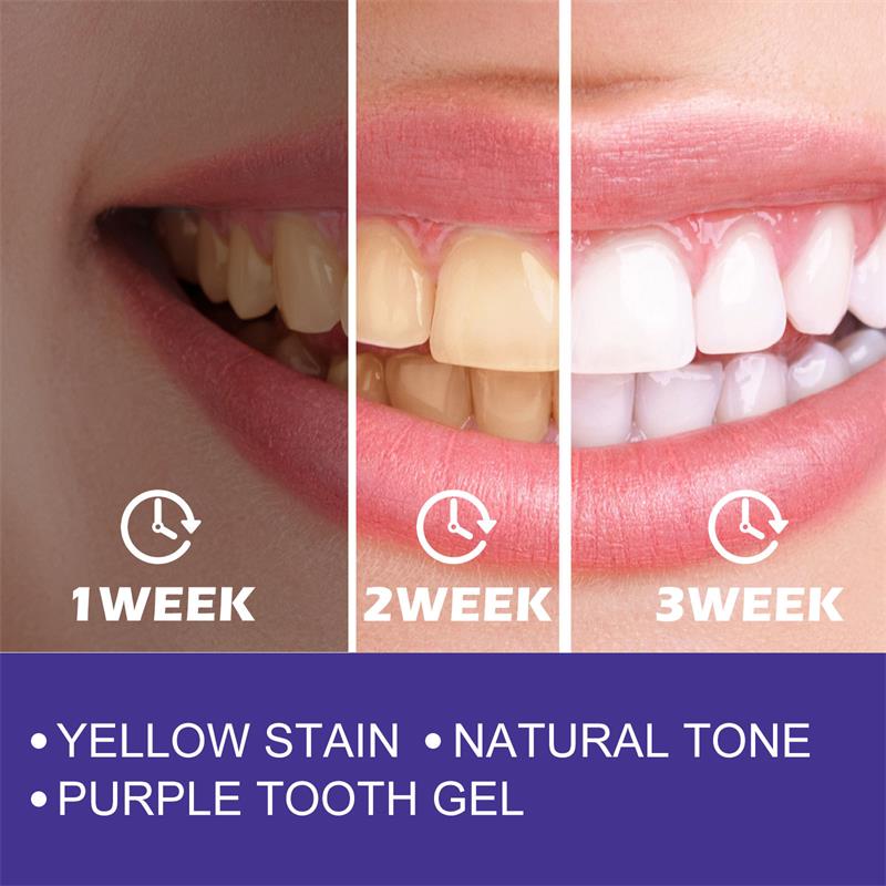Pasta de dientes piezas limpie - Teeth Whitening In Korea reseña y precio