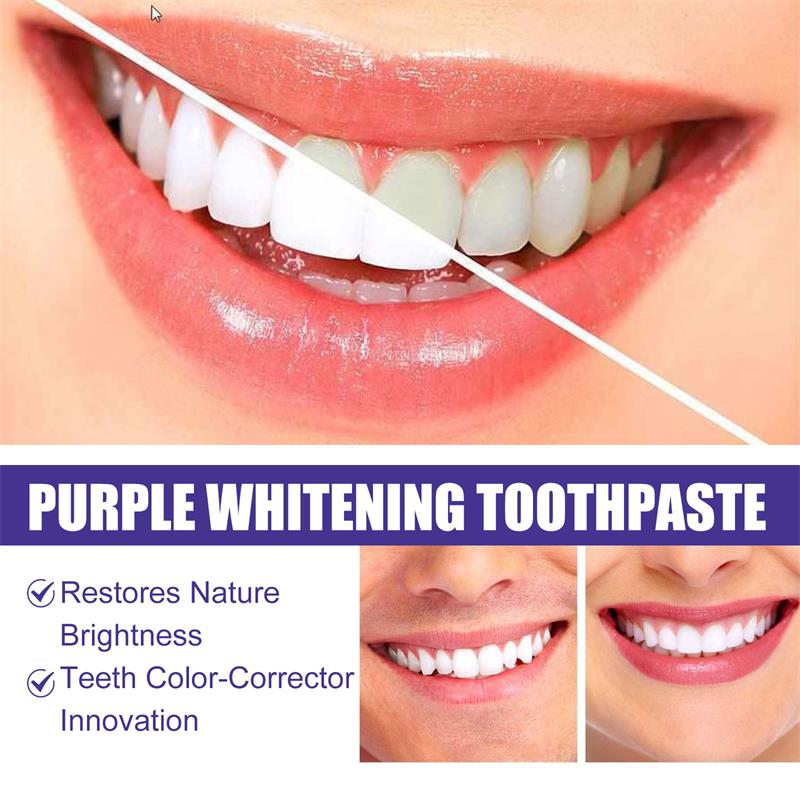 Pasta Dental Blanqueadora, Gel - Teeth Whitening In Korea reseña y precio